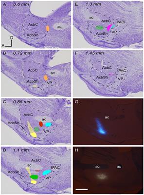 The Mesoaccumbens Pathway: A Retrograde Labeling and Single-Cell Axon Tracing Analysis in the Mouse